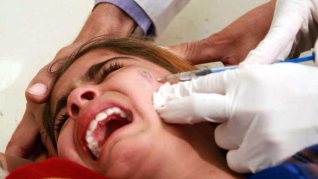 Опасна тропическа зараза пълзи след мигрантите