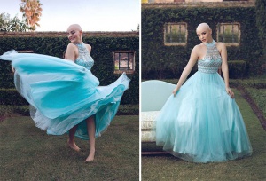 В Тексас 17-годишно момиче преодолява рака с фотосесии