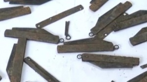 Индиец глътнал 40 джобни ножчета, открили ги след операция