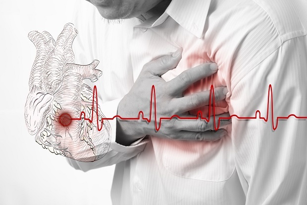 Инфарктите са най-много през януари