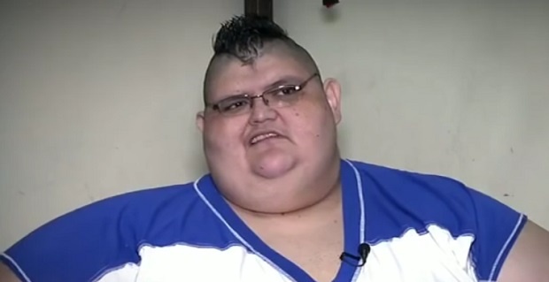 Хуан Педро - един от най-дебелите хора в света отслабна със 175 кг