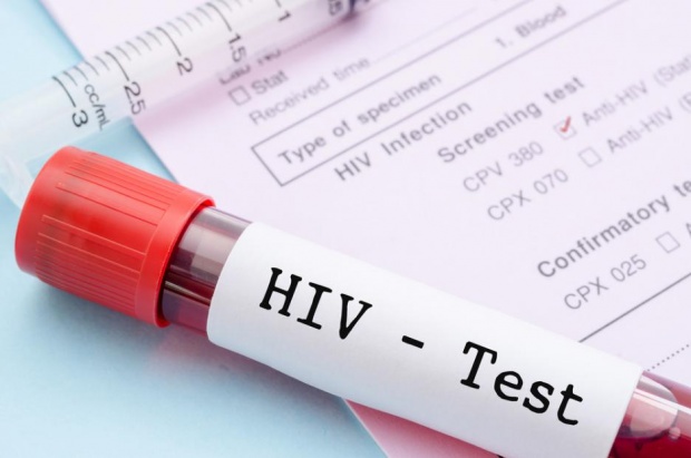 Безплатни тестове за ХИВ в София по повод на Световния ден за борба със СПИН