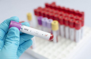 Безплатни и анонимни тестове за СПИН в Русе