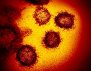 СЗО обяви как може да бъде спряна епидемията от коронавирус