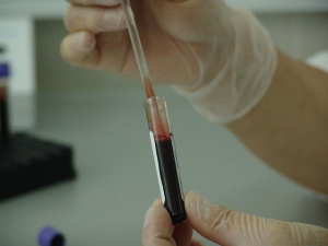 Колко са надеждни бързите тестове за коронавирус?