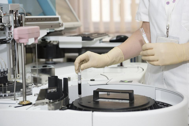 Министерството на здравеопазването ще закупи още 42 000 Real-time PCR теста
