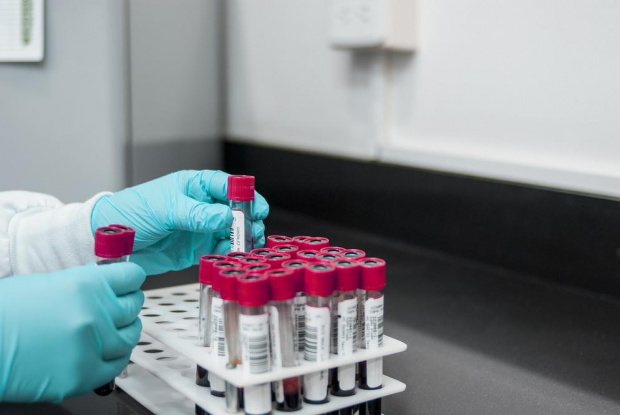 В Щатите пускат нов тест за коронавирус