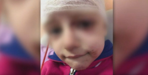 Питбул нахапа жестоко главата на 4-годишно детенце в София