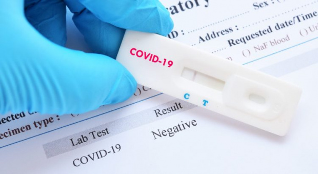 Само 1%  положителни проби за коронавирус