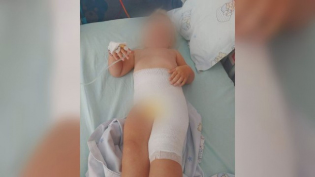 2-годишно дете получи химически изгаряния докато е на детска градина в София