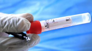 ЕС въвежда нови PCR тестове, лесно откриващи Омикрон