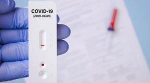 Новите случаи на коронавирус са 609, положителни са 6,7% от пробите