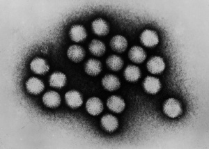 Острият хепатит с неизвестен причинител натръшка близо 200 деца