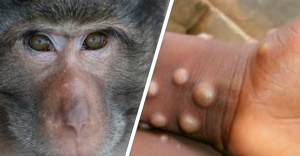 Съвпадение? Преди година глобална НПО репетира за маймунска шарка