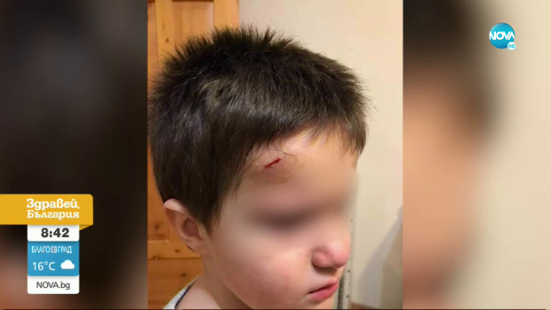Проблемни близнаци тормозят децата в столична детска градина, забиват молив в чело